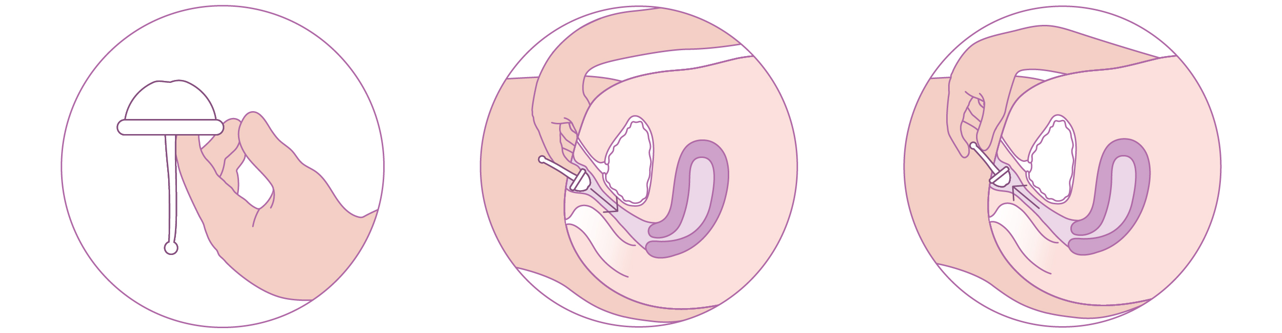 Utilisation de la coupe de conception